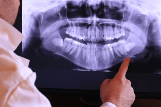Best Emergency Treatment for Toothache in Garretson, SD