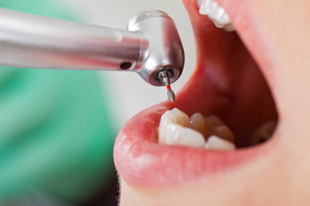 Best Emergency Orthodontic Repairs in Garretson, SD